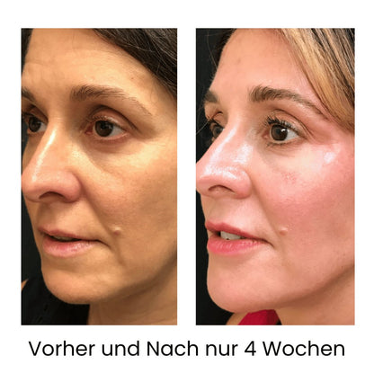 GlowBoost Pro™ Anti - Aging Gesichtsmassagegerät - Opuia